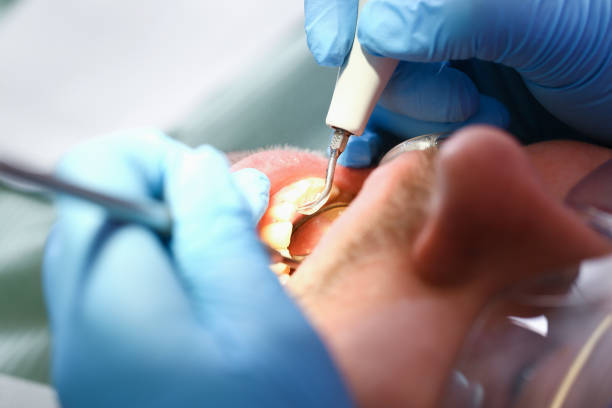 Best Cracked Tooth Emergency Dentist  in Wilkesboro, NC